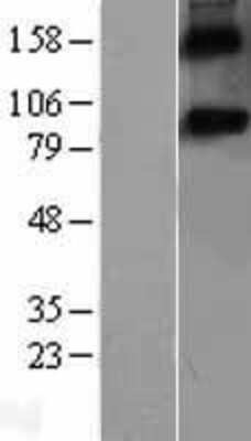 Western Blot: Spondin-1 Overexpression Lysate (Adult Normal) [NBL1-16417] Left-Empty vector transfected control cell lysate (HEK293 cell lysate); Right -Over-expression Lysate for Spondin-1.