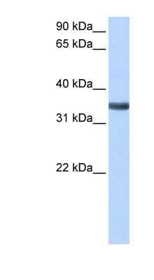 Western Blot: Spondin-2 Antibody [NBP1-59177] - Human Liver cell lysate, concentration 0.2-1 ug/ml.