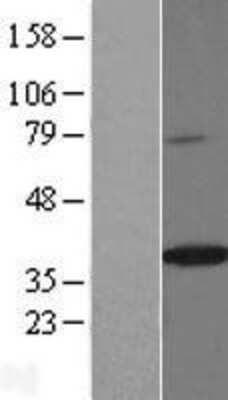 Western Blot: Spondin-2 Overexpression Lysate (Adult Normal) [NBL1-16418] Left-Empty vector transfected control cell lysate (HEK293 cell lysate); Right -Over-expression Lysate for Spondin-2.