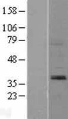 Western Blot: Sprouty 2 Overexpression Lysate (Adult Normal) [NBL1-16435] Left-Empty vector transfected control cell lysate (HEK293 cell lysate); Right -Over-expression Lysate for Sprouty 2.