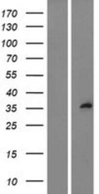 Western Blot: Sprouty Overexpression Lysate (Adult Normal) [NBL1-16434] Left-Empty vector transfected control cell lysate (HEK293 cell lysate); Right -Over-expression Lysate for Sprouty.