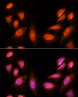 Immunocytochemistry/Immunofluorescence: Spt6 Antibody [NBP2-93722] - Analysis of U-2 OS cells using Spt6 at dilution of 1:100. Blue: DAPI for nuclear staining.