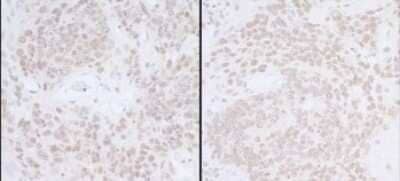 Immunohistochemistry: Spt6 Antibody [NB100-2583] - Samples: FFPE serial sections of mouse teratoma Antibody: Affinity purified rabbit anti- SUPT6H A 300-802A-1 used at a dilution of 0.4ug/ml (left) and used at a dilution of 0.2ug/ml (right) . Detection: DAB