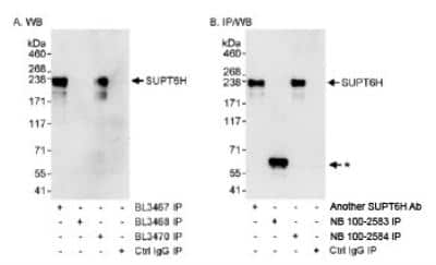 Immunoprecipitation: Spt6 Antibody [NB100-2584] - Detection of Human SUPT6H by Western Blot of  Immunoprecipitates.  Samples:  Whole cell lysate (1 mg for IP,  20% of IP loaded) from HeLa cells.   Antibodies:  Affinity purified  rabbit anti-SUPT6H antibodies NB100-2583, NB100-2584 and another SUPT6H Ab used for IP at 3 mcg/mg lysate (A and B).  Detection:  Chemiluminescence with exposure  times of 30 seconds (A and B).  * - The asterisk marks a protein with which BL3468 interacts in  IP and WB. This band is likely to be a cross-reacting protein.