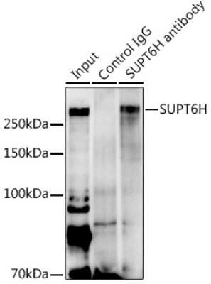 Immunoprecipitation: Spt6 Antibody [NBP2-93722] - Immunoprecipitation analysis of 600ug extracts of Mouse heart using 3ug Spt6 antibody (NBP2-93722). Western blot was performed from the immunoprecipitate using Spt6 antibody (NBP2-93722) at a dilution of 1:500.