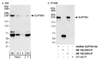 Western Blot: Spt6 Antibody [NB100-2583] - Detection of Human SUPT6H on HeLa whole cell lysate using NB100-2583. SUPT6H was successfully immunoprecipitated by another rabbit anti-SUPT6H antibody and NB100-2584.