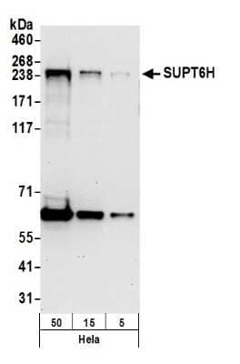 Western Blot Spt6 Antibody