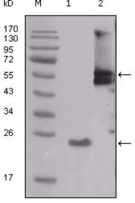 Western Blot: Src Antibody (4F1E8) [NBP1-47547] - Analysis using SRC mouse mAb against truncated SRC-His recombinant protein (1) and PMA treated THP-1 cell lysate (2).