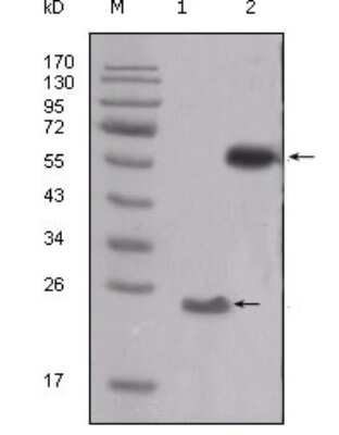 Western Blot: Src Antibody (5D10C4) [NBP1-47524] - Analysis using SRC mouse mAb against truncated SRC-His recombinant protein (1) and PMA treated THP-1 cell lysate (2).