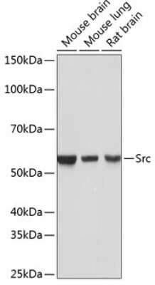 Western Blot: Src Antibody (7G6M9) [NBP3-15675] - Western blot analysis of extracts of various cell lines, using Src antibody (NBP3-15675) at 1:1000 dilution. Secondary antibody: HRP Goat Anti-Rabbit IgG (H+L) at 1:10000 dilution. Lysates/proteins: 25ug per lane. Blocking buffer: 3% nonfat dry milk in TBST. Detection: ECL Basic Kit. Exposure time: 1s.