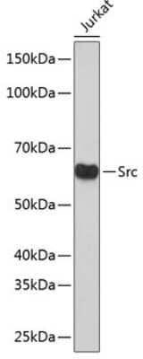 Western Blot: Src Antibody (7G6M9) [NBP3-15675] - Western blot analysis of extracts of Jurkat cells, using Src antibody (NBP3-15675) at 1:1000 dilution. Secondary antibody: HRP Goat Anti-Rabbit IgG (H+L) at 1:10000 dilution. Lysates/proteins: 25ug per lane. Blocking buffer: 3% nonfat dry milk in TBST. Detection: ECL Basic Kit. Exposure time: 1min.