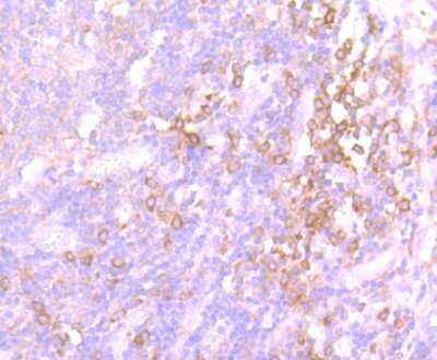 Immunohistochemistry-Paraffin: Src Antibody (JF0947) [NBP2-67167] - Analysis of paraffin-embedded human tonsil tissue using anti-Src antibody. Counter stained with hematoxylin.