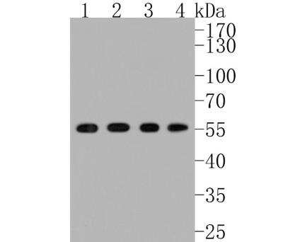 Western Blot: Src Antibody (JF0947) [NBP2-67167] - Analysis of Src on different lysates. Proteins were transferred to a PVDF membrane and blocked with 5% BSA in PBS for 1 hour at room temperature. The primary antibody (1/500) was used in 5% BSA at room temperature for 2 hours. Goat Anti-Rabbit IgG - HRP Secondary Antibody  at 1:5,000 dilution was used for 1 hour at room temperature. Positive control: Lane 1: HUVEC cell lysateLane 2: A549 cell lysateLane 3: PC-3M cell lysateLane 4: SH-SY5Y cell lysate