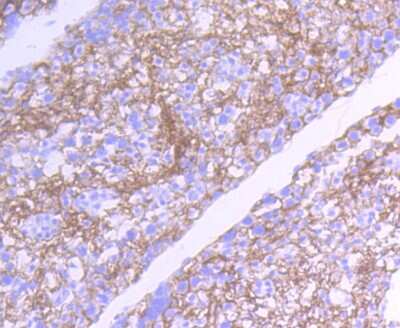 Immunohistochemistry-Paraffin: Src Antibody (ST05-03) [NBP2-67536] - Analysis of paraffin-embedded rat testis tissue using anti-Src antibody. Counter stained with hematoxylin.