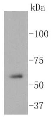 Western Blot: Src Antibody (ST05-03) [NBP2-67536] - Analysis of Src on A431 cell lysates using anti-Src antibody at 1/1,000 dilution.