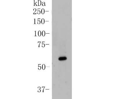 Western Blot: Src [p Tyr419] Antibody (ST0800) [NBP2-67495] - Analysis of Phospho-Src(Y419) on A549 cell lysate. Proteins were transferred to a PVDF membrane and blocked with 5% BSA in PBS for 1 hour at room temperature. The primary antibody (1:500) was used in 5% BSA at room temperature for 2 hours. Goat Anti-Rabbit IgG - HRP Secondary Antibody at 1:5,000 dilution was used for 1 hour at room temperature.
