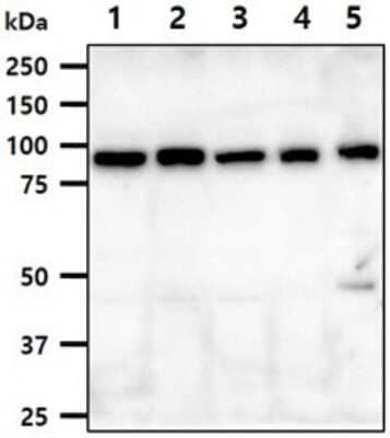 Western Blot: Ssu72 Antibody (45E2) [NBP2-60233] - The cell lysates (40ug) were resolved by SDS-PAGE, transferred to PVDF membrane and probed with anti-human Ssu72 antibody (1:1000). Proteins were visualized using a goat anti-mouse secondary antibody conjugated to HRP and an ECL detection system.Lane 1.: Jurkat cell lysateLane 2.: K562 cell lysate Lane 3.: HeLa cell lysate Lane 4.: MCF7 cell lysate  Lane 5.: LnCap cell lysate