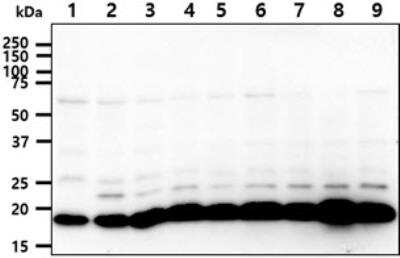 Western Blot: Ssu72 Antibody (66D10) [NBP2-60236] - The cell lysates were resolved by SDS-PAGE, transferred to PVDF membrane and probed with anti-human SSU72 antibody. Proteins were visualized using a goat anti-mouse secondary antibody conjugated to HRP and an ECL detection system. Lane 1.: Jurkat cell lysate Lane 2.: K562 cell lysate Lane 3.: 293T cell lysate Lane 4.: HepG2 cell lysate Lane 5.: A549 cell lysate Lane 6.: MCF-7 cell lysate Lane 7.: SK-OV-3 cell lysate Lane 8.: LnCap cell lysate Lane 9.: HeLa cell lysate