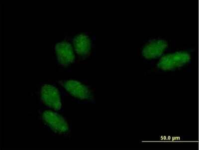 Immunocytochemistry/Immunofluorescence: Ssu72 Antibody [H00029101-B01P] - Analysis of purified antibody to SSU72 on HeLa cell. (antibody concentration 10 ug/ml)