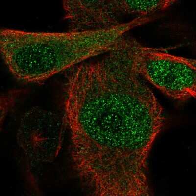 Immunocytochemistry/Immunofluorescence: Ssu72 Antibody [NBP2-57318] - Staining of human cell line SK-MEL-30 shows localization to nucleoplasm & cytosol.