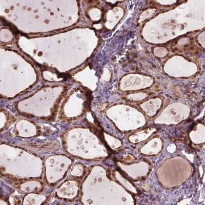 Immunohistochemistry-Paraffin Ssu72 Antibody