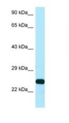 Western Blot: Ssu72 Antibody [NBP1-98498] - Titration: 1.0 ug/ml Positive Control: Placenta.