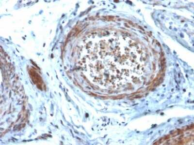 Immunohistochemistry-Paraffin: StAR Antibody (STAR/2077) - Azide and BSA Free [NBP3-08547] - Formalin-fixed, paraffin-embedded human Testis stained with StAR Mouse Monoclonal Antibody (STAR/2077).