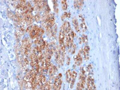 Immunohistochemistry-Paraffin: StAR Antibody (STAR/2154) - Azide and BSA Free [NBP2-75742] - Formalin-fixed, paraffin-embedded human Adrenal Gland stained with StAR Mouse Monoclonal Antibody (STAR/2154).