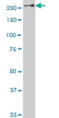 Western Blot: Stabilin-1 Antibody [H00023166-A01] - Analysis of STAB1 expression in SJCRH30 (Cat # L027V1).