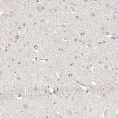 Immunohistochemistry-Paraffin: Stabilin-2 Antibody [NBP1-84197] - Staining of human cerebral cortex shows low expression as expected.