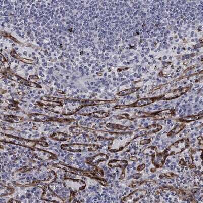 Immunohistochemistry-Paraffin: Stabilin-2 Antibody [NBP3-17092] - Staining of human spleen shows high expression.