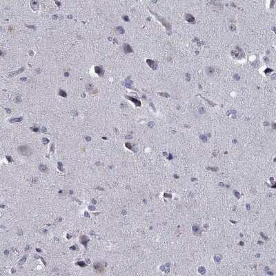 Immunohistochemistry-Paraffin: Stabilin-2 Antibody [NBP3-17092] - Staining of human cerebral cortex shows low expression as expected.