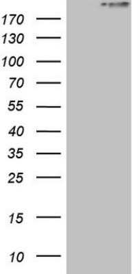 Western Blot: Stabilin-2 Antibody (OTI2E12) - Azide and BSA Free [NBP2-74373] - HEK293T cells were transfected with the pCMV6-ENTRY control (Left lane) or pCMV6-ENTRY STAB2 (Right lane) cDNA for 48 hrs and lysed. Equivalent amounts of cell lysates (5 ug per lane) were separated by SDS-PAGE and immunoblotted with anti-STAB2.