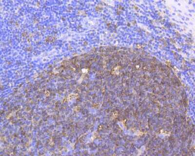 Immunohistochemistry: Stathmin 1 Antibody (11E1) [NBP2-76906] - Immunohistochemical analysis of paraffin-embedded human tonsil tissue using anti-Stathmin 1 antibody. The section was pre-treated using heat mediated antigen retrieval with Tris-EDTA buffer (pH 8.0-8.4) for 20 minutes.The tissues were blocked in 5% BSA for 30 minutes at room temperature, washed with ddH2O and PBS, and then probed with the antibody at 1/200 dilution, for 30 minutes at room temperature and detected using an HRP conjugated compact polymer system. DAB was used as the chrogen. Counter stained with hematoxylin and mounted with DPX.