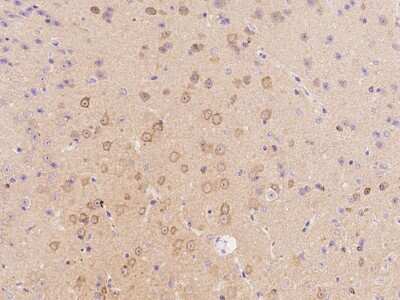 Immunohistochemistry-Paraffin: Stathmin 1 Antibody [NBP2-99433] - Staining of mouse Stathmin 1 in mouse brain with rabbit polyclonal antibody at 1:500 dilution.