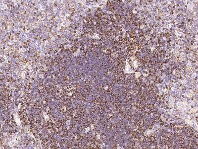 Immunohistochemistry-Paraffin: Stathmin 1 Antibody [NBP2-99433] - Staining of mouse Stathmin 1 in mouse thymus with rabbit polyclonal antibody at 1:500 dilution.