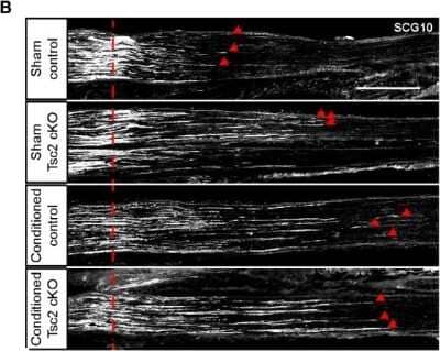 Neuronal deletion of Tsc2 improves axon regeneration within the first 2 d following nerve injury. SCG10 immunostaining of sciatic nerves 1 d after crush injury in control and Tsc2 cKO mice with (conditioned) or without (sham) a conditioning injury. Red dotted line denotes the crush site while red arrowheads point to the three longest axons. Scale bar: 500 i1/4m. Image collected and cropped by Citeab from the following publication (Nociceptor Deletion of Tsc2 Enhances Axon Regeneration by Inducing a Conditioning Injury Response in Dorsal Root Ganglia. Eneuro (2019) licensed under a CC-BY license.