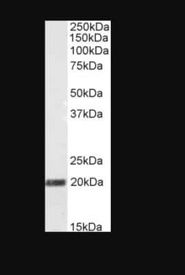 Western Blot: Stathmin-2/STMN2 Antibody [NB100-1403] - (0.5ug/ml) staining of Mouse Foetal Brain lysate (35ug protein in RIPA buffer). Primary incubation was 1 hour. Detected by chemiluminescence.