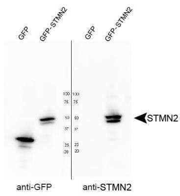 <b>Expression of Tagged Proteins Validation. </b>Analysis of STMN2 in HEK293T cells transfected with GFP or a GFP-STMN2 fusion. NBP1-49461 was used at a dilution of 1:4000. Image courtesy of Dr. Jung Eun Shin.