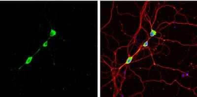 Immunocytochemistry/Immunofluorescence: Staufen Antibody [NBP1-33202] - DIV9 rat E18 primary hippocampal neuron cells were fixed in 4% paraformaldehyde at RT for 15 min. Green: Staufen stained by Staufen antibody diluted at 1:500.Red: beta Tubulin 3/ Tuj1, stained by beta Tubulin 3/ Tuj1 antibody [11710]  diluted at 1:500. Blue: Fluoroshield with DAPI.