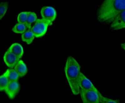 Immunocytochemistry/Immunofluorescence: Staufen Antibody (JU30-85) [NBP2-75674] - Staining Staufen in LOVO cells (green). The nuclear counter stain is DAPI (blue). Cells were fixed in paraformaldehyde, permeabilised with 0.25% Triton X100/PBS.