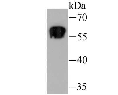 Western Blot: Staufen Antibody (JU30-85) [NBP2-75674] - Analysis of Staufen on K562 cell using anti-Staufen antibody at 1/1,000 dilution.