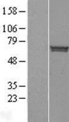 Western Blot: Staufen Overexpression Lysate (Adult Normal) [NBL1-16531] Left-Empty vector transfected control cell lysate (HEK293 cell lysate); Right -Over-expression Lysate for Staufen.