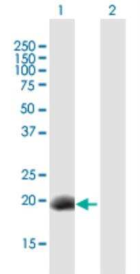 Western Blot: Stella/Dppa3 Antibody [H00359787-B01P-50ug] - Analysis of DPPA3 expression in transfected 293T cell line (H00359787-T01) by DPPA3 MaxPab polyclonal antibody.Lane 1: DPPA3 transfected lysate(17.49 KDa).Lane 2: Non-transfected lysate.