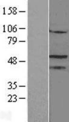 Western Blot: Steroidogenic Factor 1 Overexpression Lysate (Adult Normal) [NBL1-13782] Left-Empty vector transfected control cell lysate (HEK293 cell lysate); Right -Over-expression Lysate for Steroidogenic Factor 1.