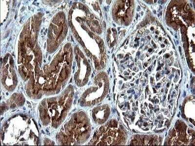 Immunohistochemistry: Sterol carrier protein 2 Antibody (OTI1E4) - Azide and BSA Free [NBP2-74401] - Analysis of Human Kidney tissue. (Heat-induced epitope retrieval by 1 mM EDTA in 10mM Tris, pH8.5, 120C for 3min)