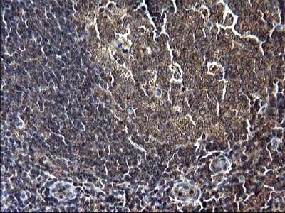 Immunohistochemistry: Sterol carrier protein 2 Antibody (OTI1E4) - Azide and BSA Free [NBP2-74401] - Analysis of Human lymph node tissue. (Heat-induced epitope retrieval by 1 mM EDTA in 10mM Tris, pH8.5, 120C for 3min)