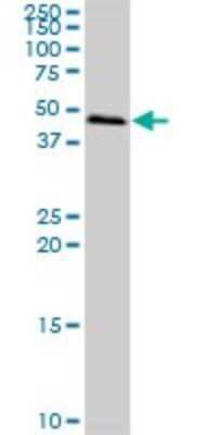 Western Blot: Sterol carrier protein 2 Antibody [H00006342-B01P] - Analysis of SCP2 expression in A-431.