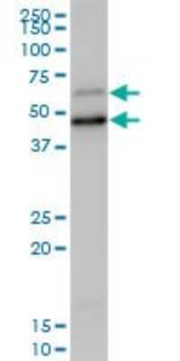 Western Blot: Sterol carrier protein 2 Antibody [H00006342-B01P] - Analysis of SCP2 expression in human liver.