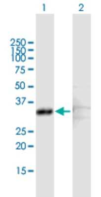 Western Blot: Sterol carrier protein 2 Antibody [H00006342-B01P] - Analysis of SCP2 expression in transfected 293T cell line by SCP2 polyclonal antibody.  Lane 1: SCP2 transfected lysate(35.42 KDa). Lane 2: Non-transfected lysate.